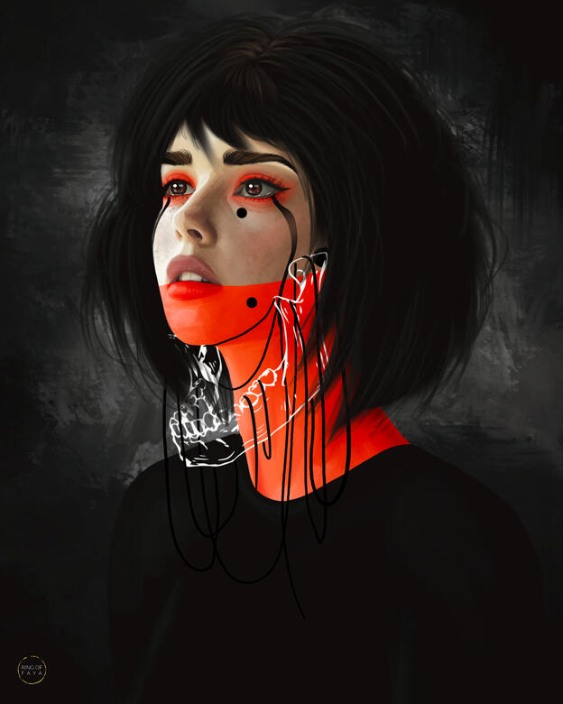 Trigeminal Neuralgia